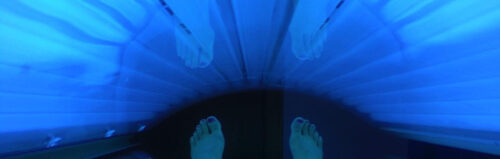 uvb phototherapy